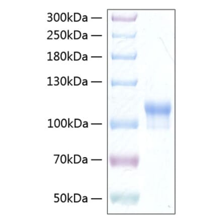 SDS-PAGE - Recombinant Human Neuroligin 3 Protein (C-terminal His Tag) (A331768) - Antibodies.com
