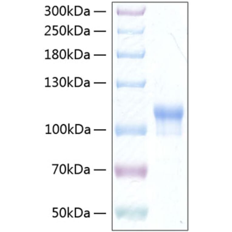 SDS-PAGE - Recombinant Human Neuroligin 3 Protein (C-terminal His Tag) (A331768) - Antibodies.com