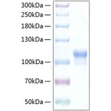 SDS-PAGE - Recombinant Human Neuroligin 3 Protein (C-terminal His Tag) (A331768) - Antibodies.com