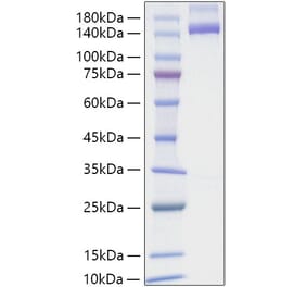 SDS-PAGE - Recombinant Human NRP2 Protein (C-terminal Human Fc and His Tag) (A331769) - Antibodies.com