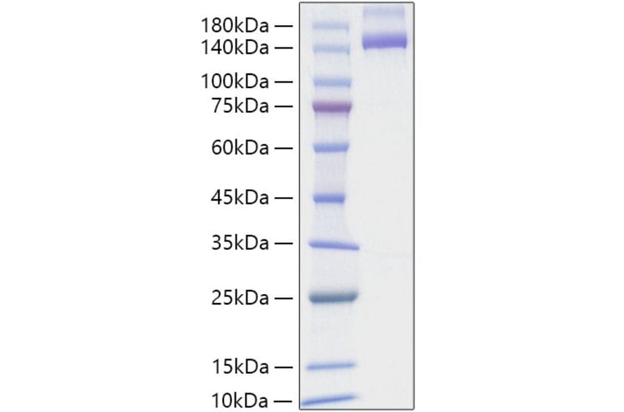 SDS-PAGE - Recombinant Human NRP2 Protein (C-terminal Human Fc and His Tag) (A331769) - Antibodies.com