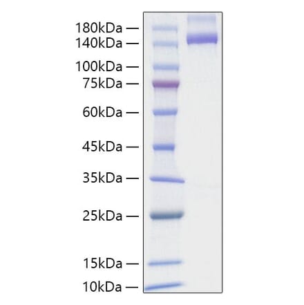SDS-PAGE - Recombinant Human NRP2 Protein (C-terminal Human Fc and His Tag) (A331769) - Antibodies.com