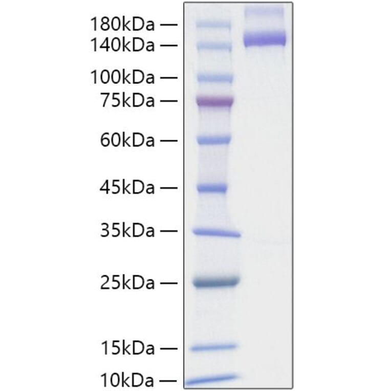 SDS-PAGE - Recombinant Human NRP2 Protein (C-terminal Human Fc and His Tag) (A331769) - Antibodies.com