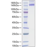 SDS-PAGE - Recombinant Human NRP2 Protein (C-terminal Human Fc and His Tag) (A331769) - Antibodies.com