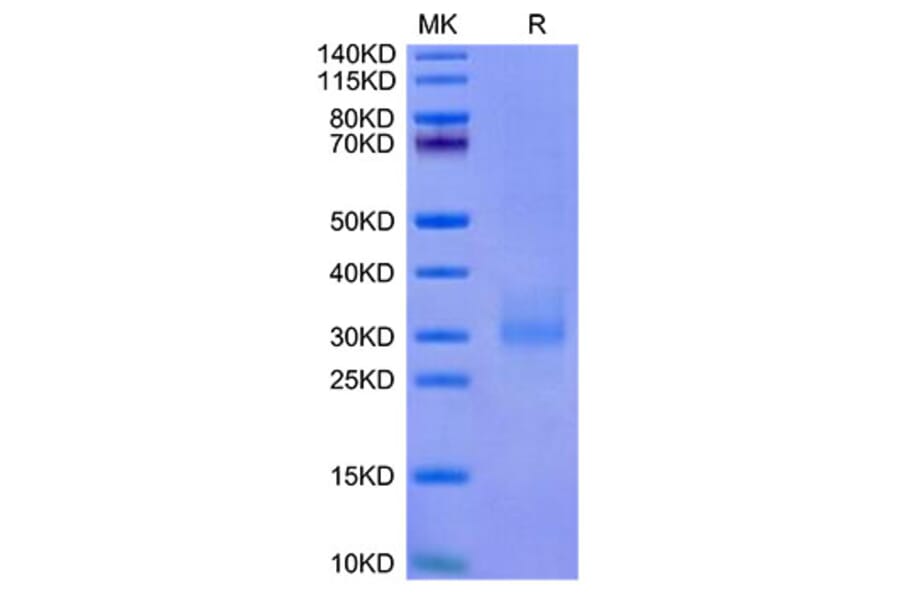 Tris-Bis PAGE - Recombinant Cynomolgus macaque NKG2A + KLRD1 Protein (C-terminal His and Flag Tag) (A331770) - Antibodies.com