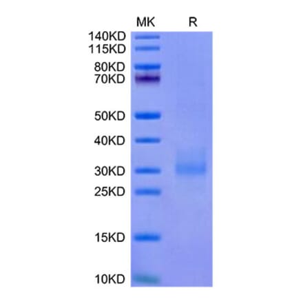 Tris-Bis PAGE - Recombinant Cynomolgus macaque NKG2A + KLRD1 Protein (C-terminal His and Flag Tag) (A331770) - Antibodies.com