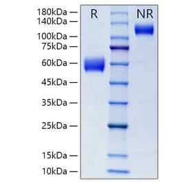 SDS-PAGE - Recombinant Mouse NKG2D Protein (N-terminal Human Fc Tag) (A331771) - Antibodies.com