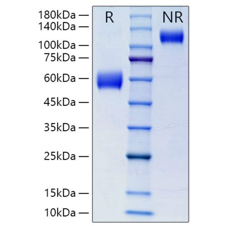 SDS-PAGE - Recombinant Mouse NKG2D Protein (N-terminal Human Fc Tag) (A331771) - Antibodies.com