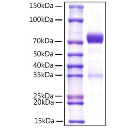 SDS-PAGE - Recombinant Mouse NCR1 Protein (C-terminal Rabbit Fc Tag) (A331772) - Antibodies.com