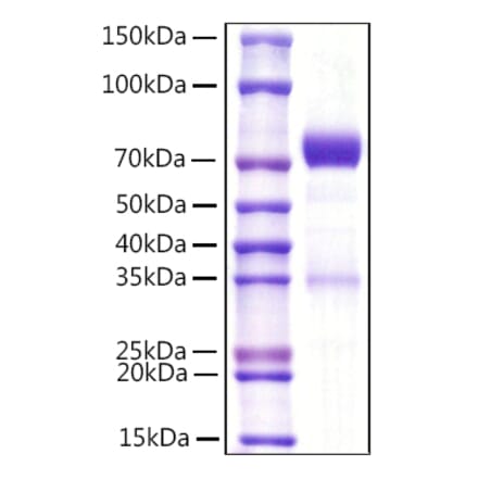 SDS-PAGE - Recombinant Mouse NCR1 Protein (C-terminal Rabbit Fc Tag) (A331772) - Antibodies.com