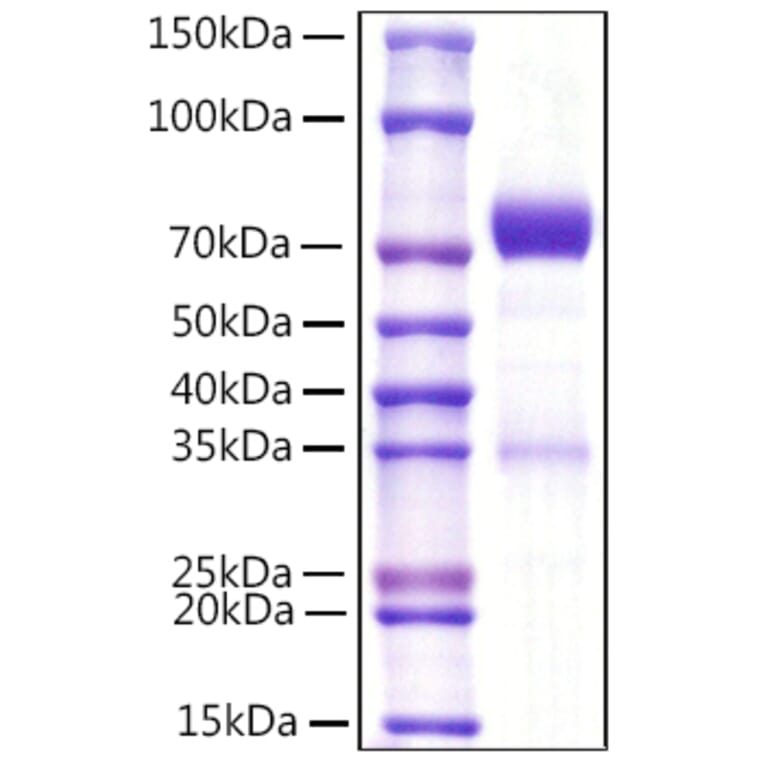 SDS-PAGE - Recombinant Mouse NCR1 Protein (C-terminal Rabbit Fc Tag) (A331772) - Antibodies.com