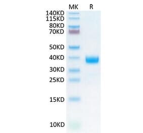 Tris-Bis PAGE - Recombinant Cynomolgus macaque NCR1 Protein (C-terminal His Tag) (A331773) - Antibodies.com
