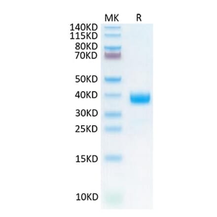 Tris-Bis PAGE - Recombinant Cynomolgus macaque NCR1 Protein (C-terminal His Tag) (A331773) - Antibodies.com