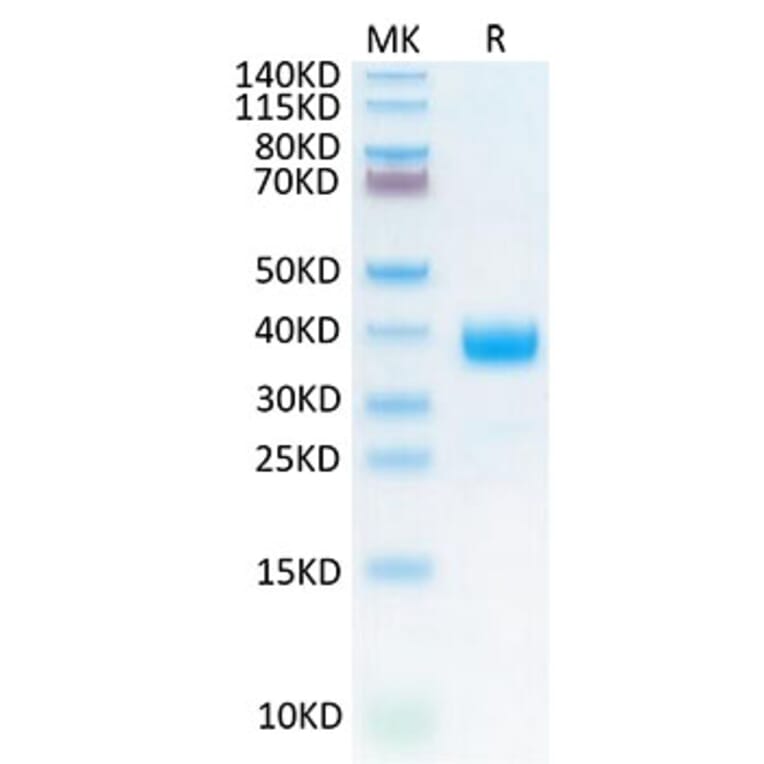 Tris-Bis PAGE - Recombinant Cynomolgus macaque NCR1 Protein (C-terminal His Tag) (A331773) - Antibodies.com