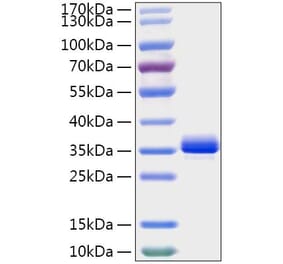 SDS-PAGE - Recombinant Mouse Noggin Protein (C-terminal His Tag) (A331774) - Antibodies.com