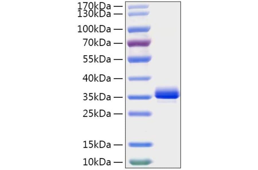 SDS-PAGE - Recombinant Mouse Noggin Protein (C-terminal His Tag) (A331774) - Antibodies.com