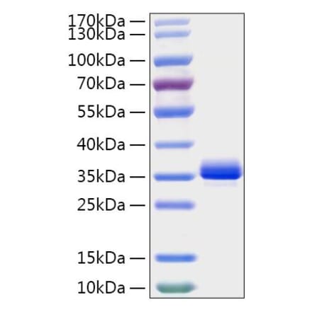 SDS-PAGE - Recombinant Mouse Noggin Protein (C-terminal His Tag) (A331774) - Antibodies.com