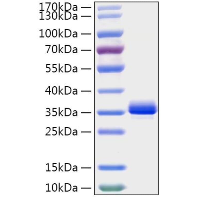 SDS-PAGE - Recombinant Mouse Noggin Protein (C-terminal His Tag) (A331774) - Antibodies.com