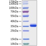 SDS-PAGE - Recombinant Mouse Noggin Protein (C-terminal His Tag) (A331774) - Antibodies.com