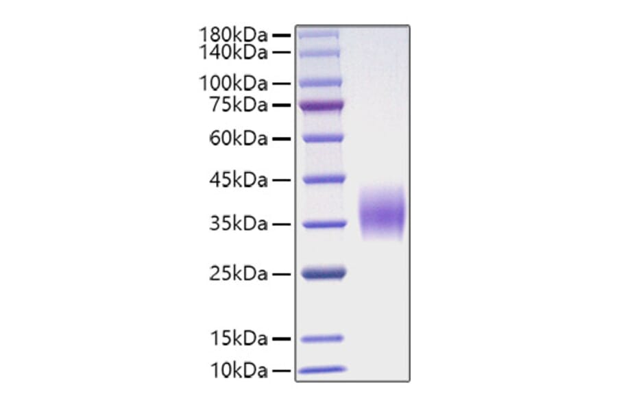 SDS-PAGE - Recombinant Mouse OSM Protein (C-terminal His Tag) (A331778) - Antibodies.com
