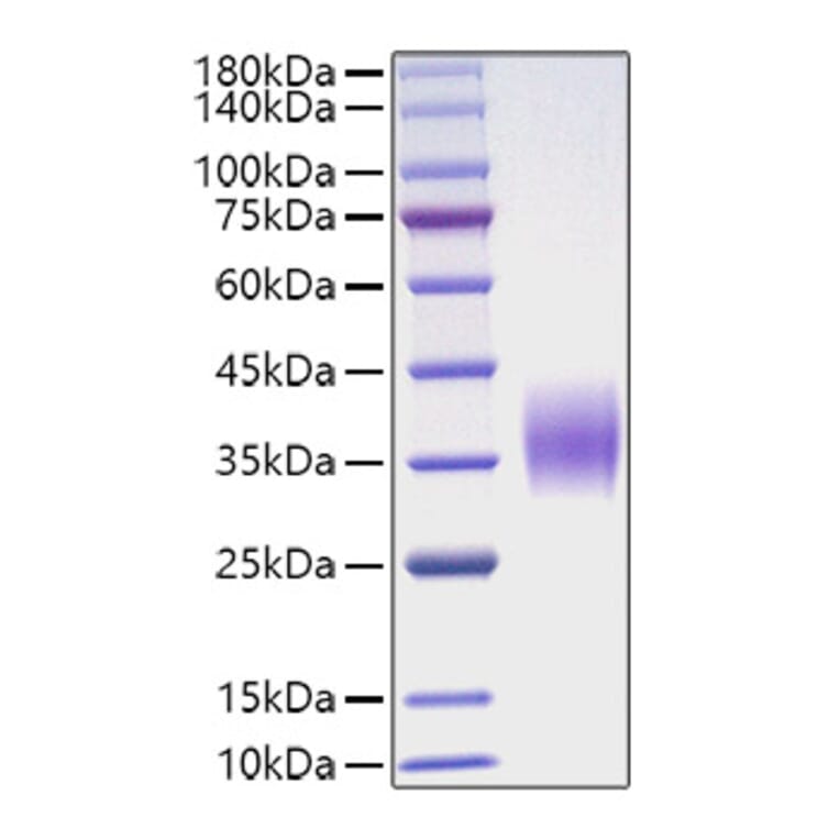 SDS-PAGE - Recombinant Mouse OSM Protein (C-terminal His Tag) (A331778) - Antibodies.com