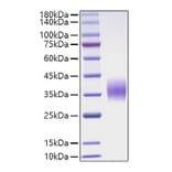 SDS-PAGE - Recombinant Mouse OSM Protein (C-terminal His Tag) (A331778) - Antibodies.com