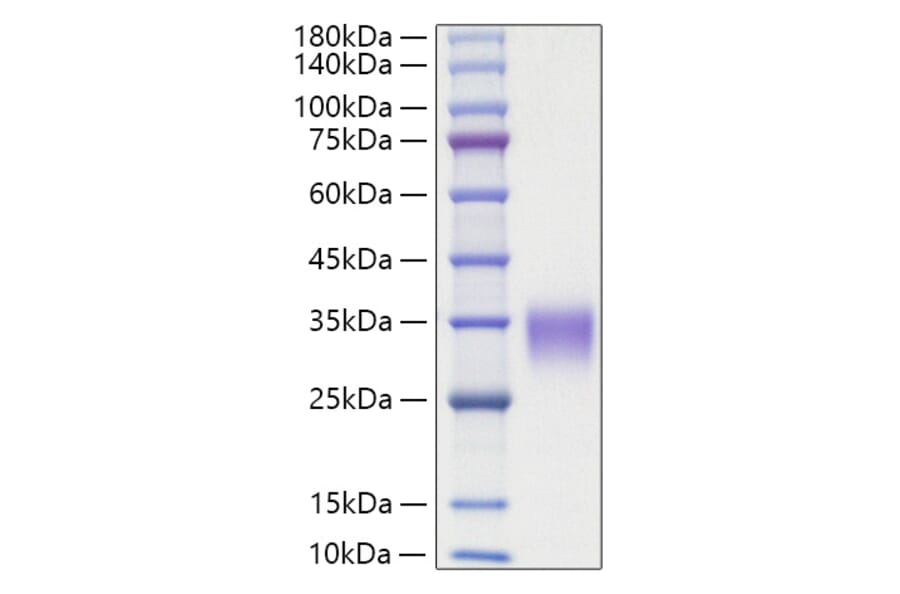 SDS-PAGE - Recombinant Rat OSM Protein (C-terminal His Tag) (A331779) - Antibodies.com