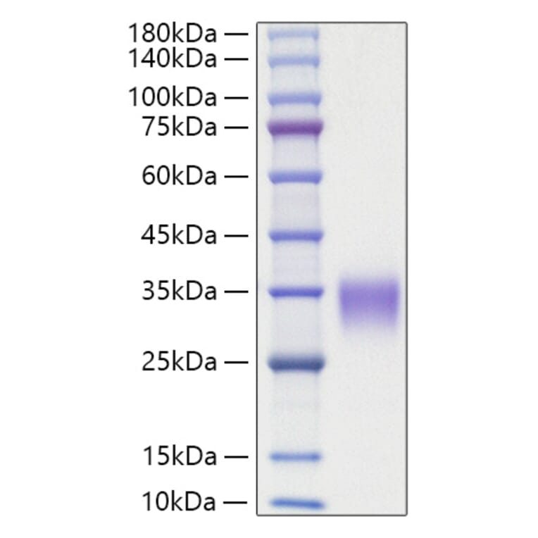 SDS-PAGE - Recombinant Rat OSM Protein (C-terminal His Tag) (A331779) - Antibodies.com