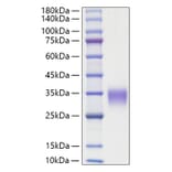 SDS-PAGE - Recombinant Rat OSM Protein (C-terminal His Tag) (A331779) - Antibodies.com