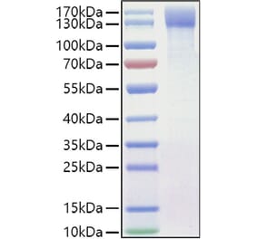 SDS-PAGE - Recombinant Mouse OSMR Protein (C-terminal His Tag) (A331780) - Antibodies.com