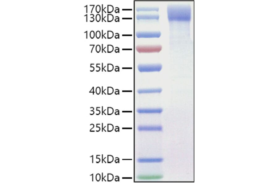 SDS-PAGE - Recombinant Mouse OSMR Protein (C-terminal His Tag) (A331780) - Antibodies.com