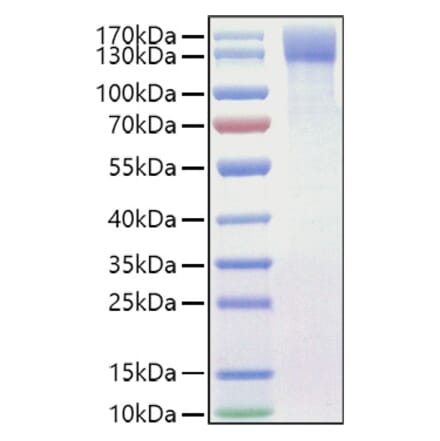 SDS-PAGE - Recombinant Mouse OSMR Protein (C-terminal His Tag) (A331780) - Antibodies.com