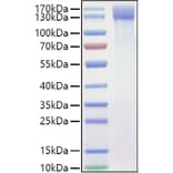 SDS-PAGE - Recombinant Mouse OSMR Protein (C-terminal His Tag) (A331780) - Antibodies.com