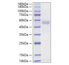 SDS-PAGE - Recombinant Mouse Osteopontin Protein (C-terminal His Tag) (A331781) - Antibodies.com