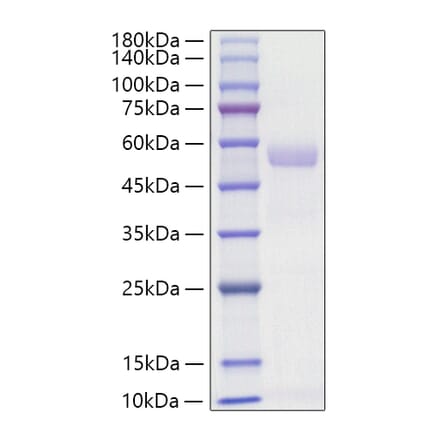 SDS-PAGE - Recombinant Mouse Osteopontin Protein (C-terminal His Tag) (A331781) - Antibodies.com