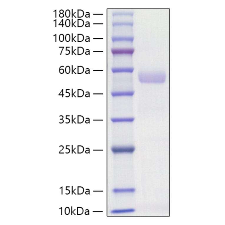 SDS-PAGE - Recombinant Mouse Osteopontin Protein (C-terminal His Tag) (A331781) - Antibodies.com