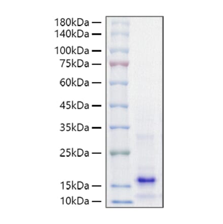 SDS-PAGE - Recombinant Mouse PTH Protein (A331785) - Antibodies.com