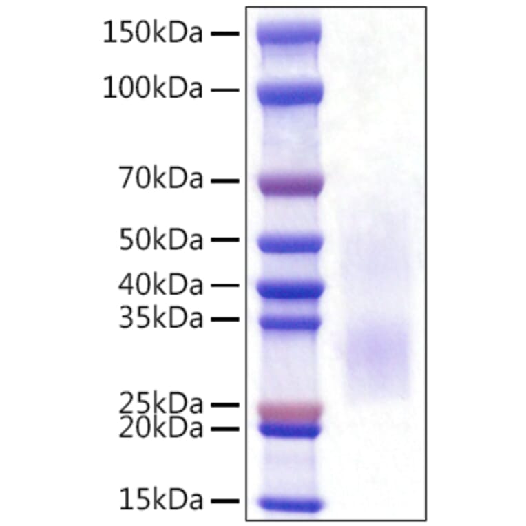 SDS-PAGE - Recombinant Rat PD1 Protein (C-terminal His Tag) (A331787) - Antibodies.com
