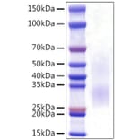 SDS-PAGE - Recombinant Rat PD1 Protein (C-terminal His Tag) (A331787) - Antibodies.com