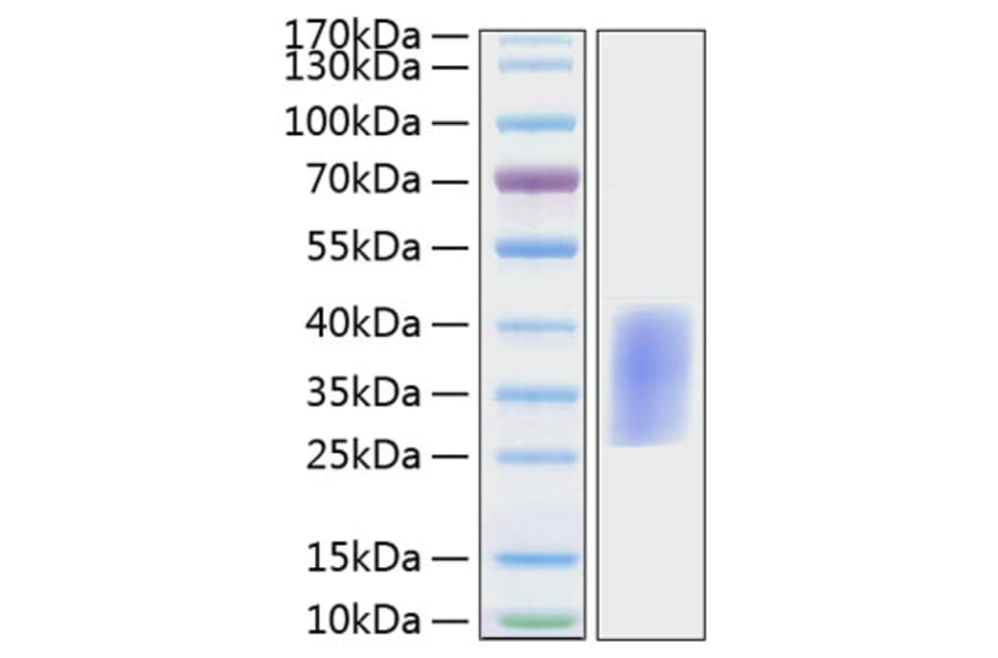 SDS-PAGE - Recombinant Mouse PD1 Protein (C-terminal His Tag) (A331788) - Antibodies.com