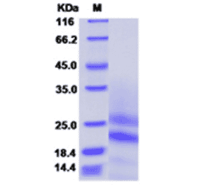 SDS-PAGE - Recombinant Mouse PDGF AA Protein (N-terminal His Tag) (A331790) - Antibodies.com