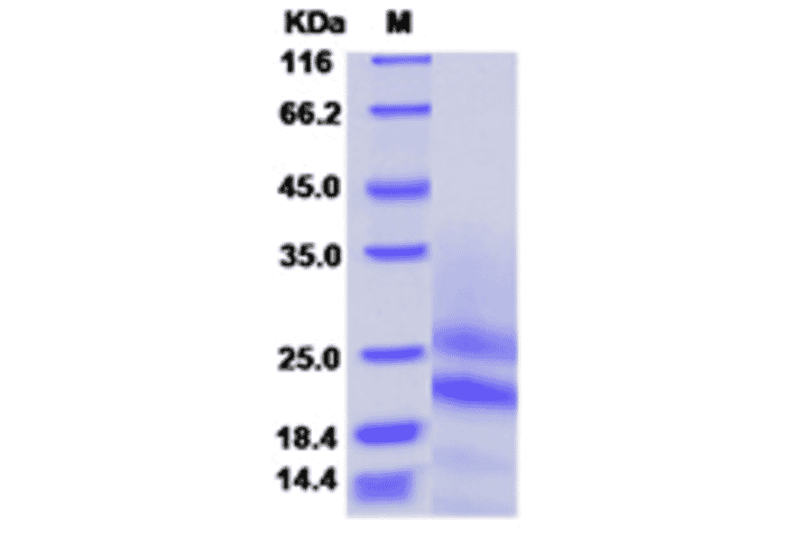 SDS-PAGE - Recombinant Mouse PDGF AA Protein (N-terminal His Tag) (A331790) - Antibodies.com
