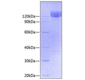 SDS-PAGE - Recombinant Mouse PDGFR alpha Protein (C-terminal Fc Tag) (A331792) - Antibodies.com