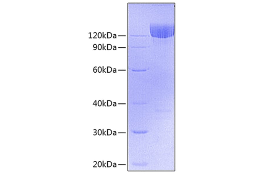 SDS-PAGE - Recombinant Mouse PDGFR alpha Protein (C-terminal Fc Tag) (A331792) - Antibodies.com