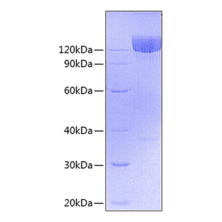 SDS-PAGE - Recombinant Mouse PDGFR alpha Protein (C-terminal Fc Tag) (A331792) - Antibodies.com