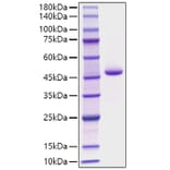 SDS-PAGE - Recombinant Human PGA4 Protein (C-terminal His Tag) (A331793) - Antibodies.com