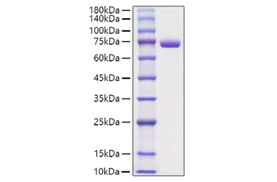 SDS-PAGE - Recombinant Mouse Periostin Protein (C-terminal His Tag) (A331794) - Antibodies.com