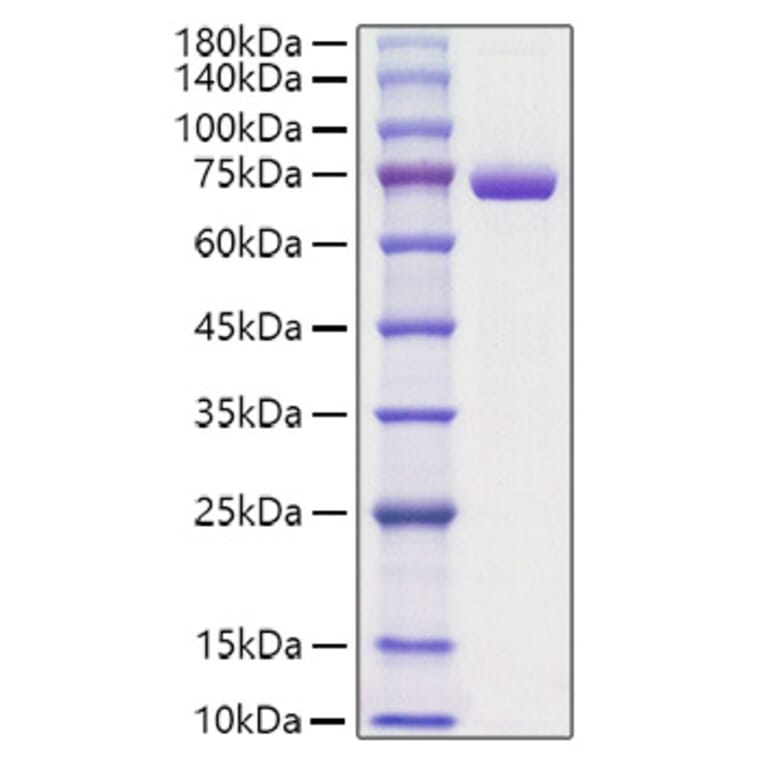 SDS-PAGE - Recombinant Mouse Periostin Protein (C-terminal His Tag) (A331794) - Antibodies.com