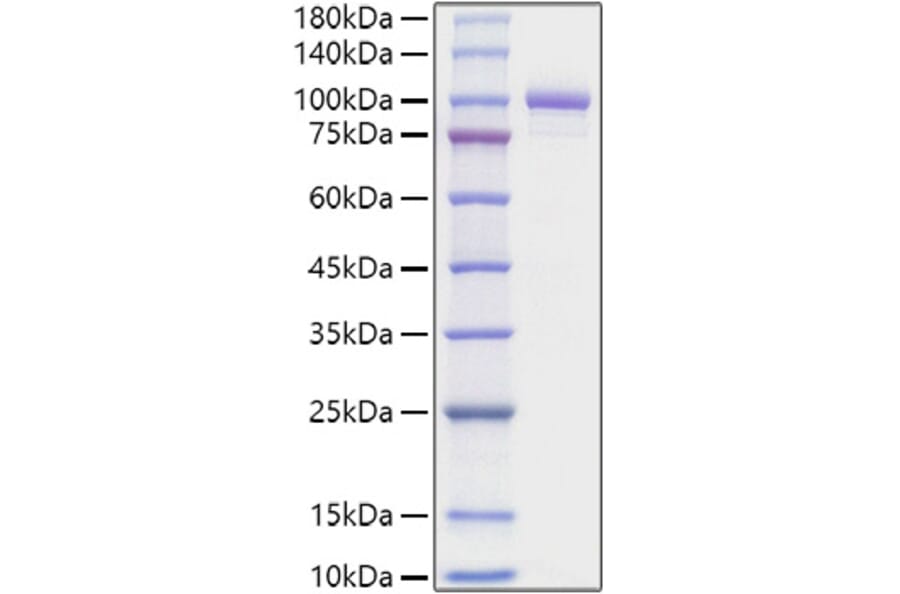 SDS-PAGE - Recombinant Mouse Periostin Protein (C-terminal His Tag) (A331795) - Antibodies.com