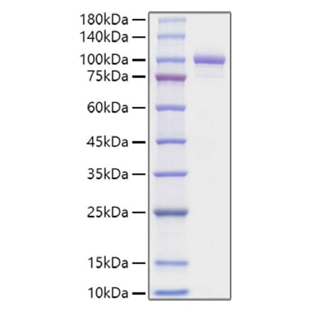 SDS-PAGE - Recombinant Mouse Periostin Protein (C-terminal His Tag) (A331795) - Antibodies.com